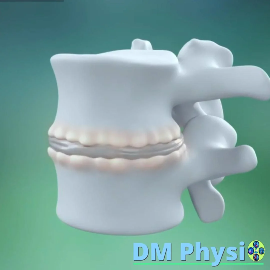 Анатомия и визуализация на остеофити в лумбалната област